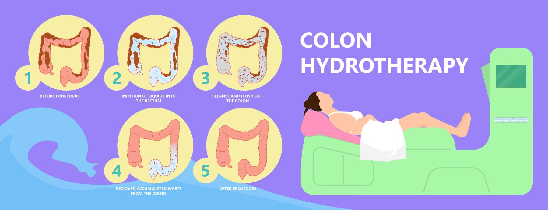 Colon Hydrotherapy