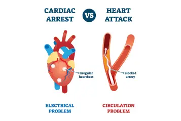 heart-attack-vs-cardiac-arrest_image
