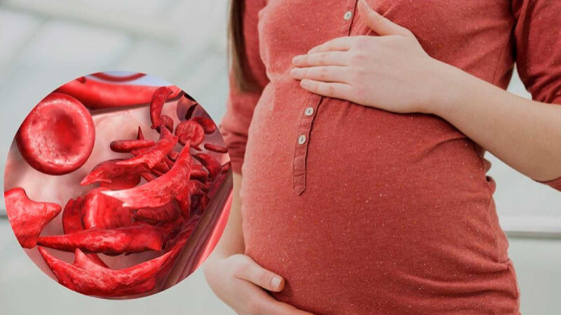 Anaemia in Pregnancy - Causes, Symptoms and Treatment Options
