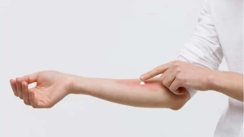 Balanitis Symptoms Causes Treatment And Prevention
