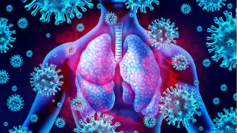 Pneumonia